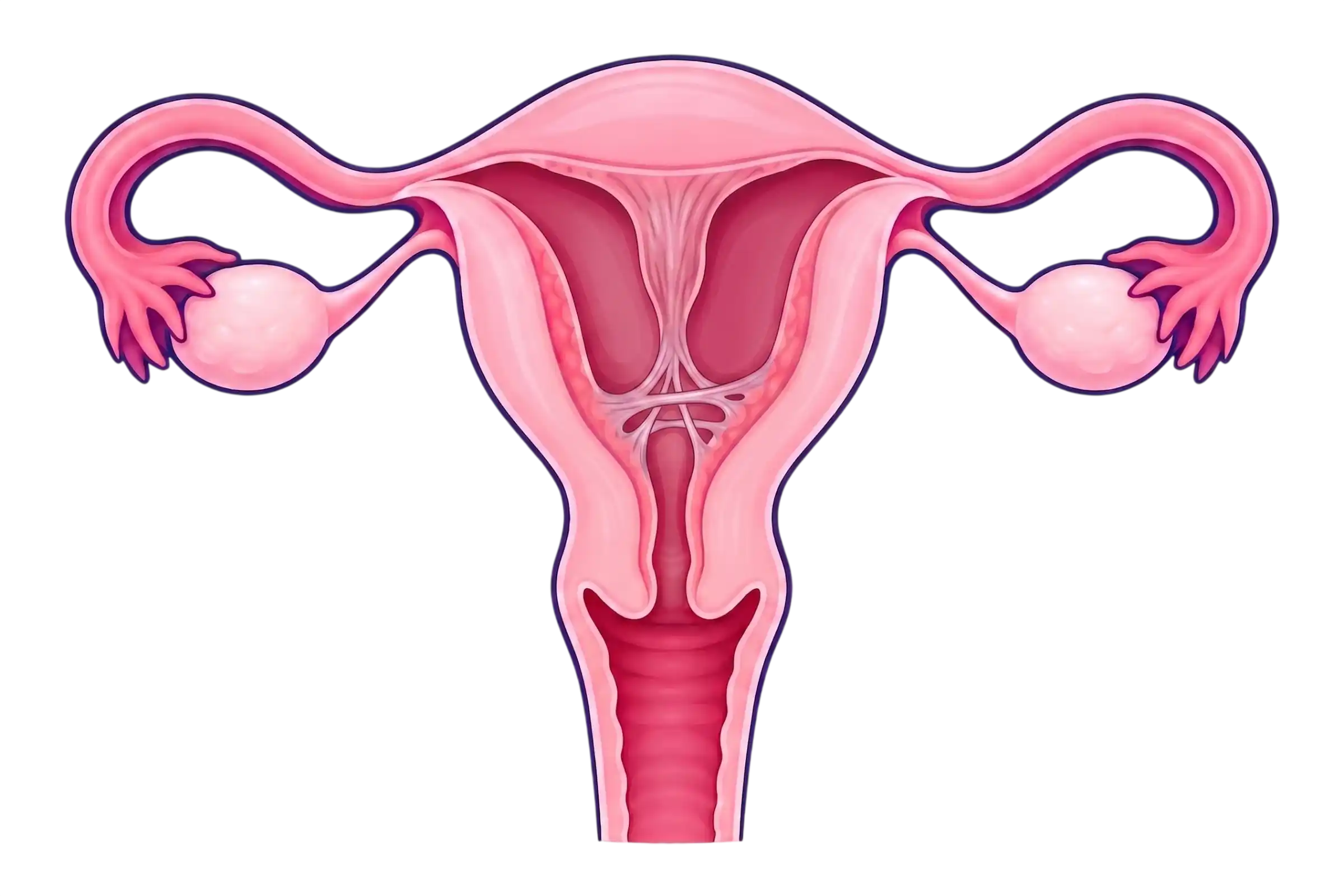 Sinequias y septos uterinos